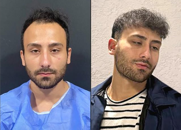 Saç ekimi öncesi sonrası 7 - MicroFUE 3500 greft